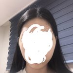 [드루와] 야 나 교정중인디 얼굴형 <b>변화</b> 어때