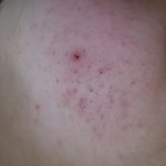 [화장품] 피부 좋아지는 법 좀 ㅠㅠ