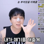 [드루와] <b>강학</b>두 성형했네