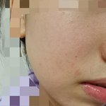 [댓글부탁해] 피부 조때써