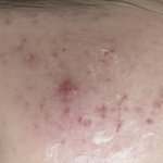[댓글부탁해] 나 <b>피부</b> 진짜 괜찮아짐 -<b>사진</b>잇음 <b>주의</b>