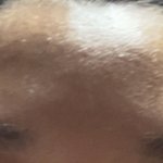 이마 이렇게 도돌도돌 돼있는거