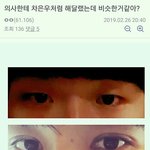 [댓글부탁해] 쌍수 <b>재수술</b>할 때 쌍수 한 사람 사진 들고가면 해...