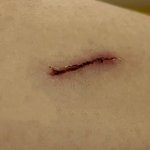 얘들아 나 다리에 <b>상처</b>남 ㅠㅠ 혐주의)
