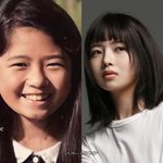 [<b>아이브</b>] 아이브레이 성형