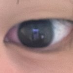 <b>눈</b> <b>앞부분</b>만 빨간데 왜이럼