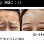 우리만 <b>성별</b>갈등 ㅈㄴ없냐