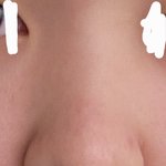 나 <b>복코</b> 많이 심함???