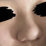 복코 심함…? ㅋㅋ…