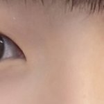 [댓글부탁해] (사진) 나 <b>짝눈</b> 교정해야 될까?ㅠ