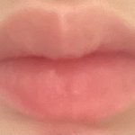 [19] (<b>사진o</b>)입주변 이렇게 되는거 어떡해?
