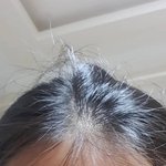 [이것좀봐줘] 나 <b>탈모</b>인가 제발 조언부탁해ㅠ