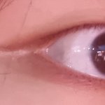 내 눈 어때?