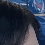 [댓글부탁해] <b>이마</b> 어떰??