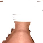 코 <b>쉐딩</b>하고 광명찾자