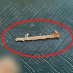 샌드위치 속 닭뼈에 목 찔려 병원行…"사과도 없었다"