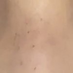 진짜… 나만큼 다크<b>서클</b> 심한사람 없음 ㄹㅇ