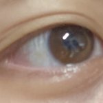 내 쌍액<b>전후</b>좀봐봐