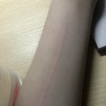 [댓글부탁해] 너네도 팔 다 이래??