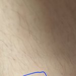 [드루와] 털주의)다리왁싱 <b>존망</b>