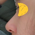콧대 ㅈㄴ 낮지?