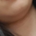 살빼기전에 <b>턱살</b> ㄹㅈㄷ다
