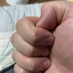 [댓글부탁해] 아니 나 이거 못없애냐..?