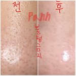 [댓글부탁해] 나 블랙<b>헤드</b> ㅈㄴ 없어졌지