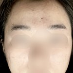 [댓글부탁해] 나 피부 많이 <b>안</b>좋은거임?ㅠ(<b>사진</b>잇음)