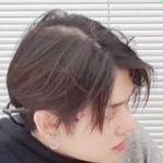 [모두드루와] 연준 <b>탈모</b> 이거 진짜야?