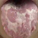 [댓글부탁해] <b>사진</b> 혐) 구내염 연고 효과있는거같애??? 이틀 써<b>봄</b>