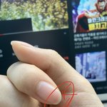 <b>손톱</b> 이렇ㄹ게됐을때 어케해야됨?