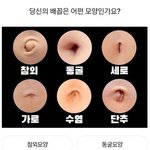살빼면 배꼽 <b>모양</b>도 바뀜??