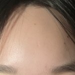 [댓글부탁해] 이마 까는 거 오바야?