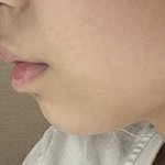 얘들아 근디 코성형은 <b>돌출</b>입 교정