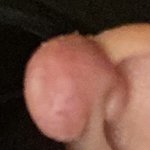 진짜 <b>연골</b>피어싱 함부로 하는거 아님
