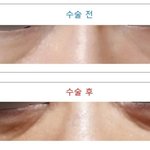 8번의 고소, 가처분 소송 및 <b>민사</b>소송까지 하며 피해환자를 끝까지...