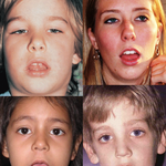 마스크로 고생한 <b>비염</b>인 있음??ㅠ