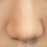 [19] 코<b>수술</b> 할건데 잘 될 코임?