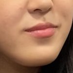 턱 긴거땜에 스트레스받는데