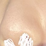 코에 이런 블랙헤드 같은거 많은데