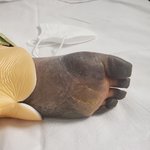 백신부작용으로 다리 절단한 <b>제친구</b>를 도와주세요