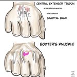 [댓글부탁해] 너네 <b>주먹</b> 쥐었다 펴봐