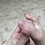 내 <b>내성</b>발톱 볼 사람 ㅋㅋ 혐주의다