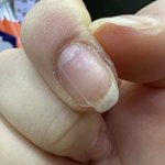 [방탈죄송] <b>손톱</b> 왜이러는거죠ㅠ