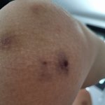 [방탈죄송] 고소당했어요 (또다른 피해자)