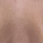 얘들아 너희는 쌍수했는데 일케 <b>짝짝이</b> 되면