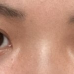 나 코<b>수술</b>할까