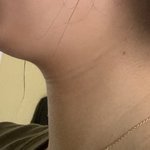 [댓글부탁해] 나 이거 <b>무턱</b> 심한편이지?