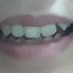 이런 <b>덧니</b> 있는애 보면 솔직히 뭔 생각듦